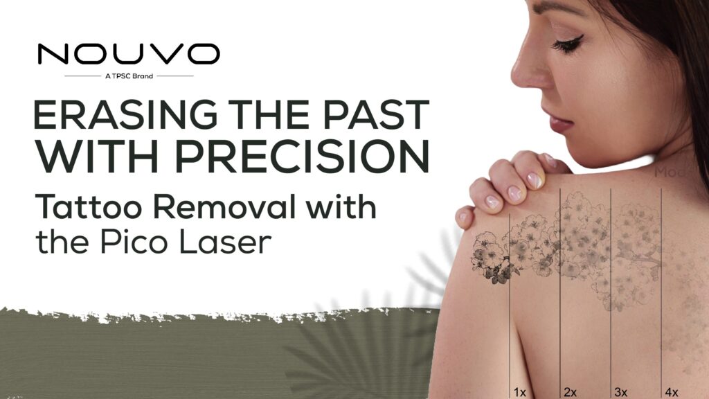 Erasing the Past with Precision Tattoo Removal with the Pico laser